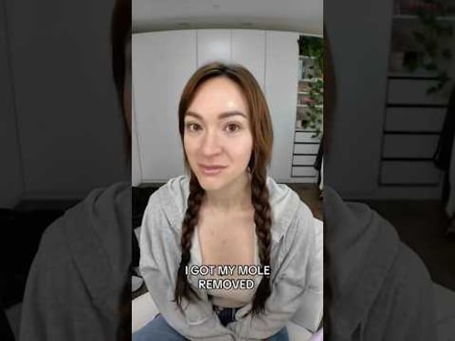 Alisha Marie Removed Her Mole