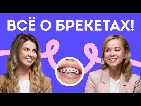 Виды брекетов, сколько стоят, жизнь с брекетами — всё, что нужно знать о брекетах! Stoma Talk
