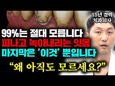 "5분만 확인하세요" 치과의사가 '이 말'하면 당장 도망치세요 순식간에 잇몸 녹아내립니다 (안상수 원장 1부)