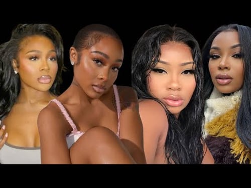 When Does Pretty Privilege End? | The Psychology of Beauty, Filler, & Internet Backlash