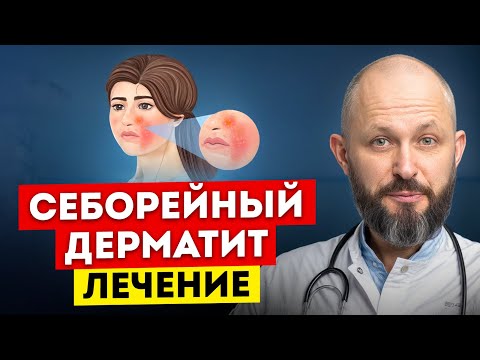 НИКОГДА не игнорируйте эти СИМПТОМЫ! / Что такое себорейный дерматит и чем он страшен?