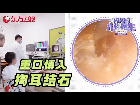 超重口! 6岁女孩耳朵被巨大耳结石堵住, 医生掏结石看得人酸爽又解压! #闪闪的儿科医生第三季 CLIP