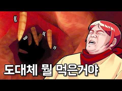 내시경 검사하는데 이상한게 보여 ㅠㅠㅠㅠ