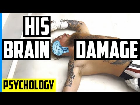 Here’s the exact brain damage Jake Paul may suffer from boxing AJ – Psychology, Neuroscience