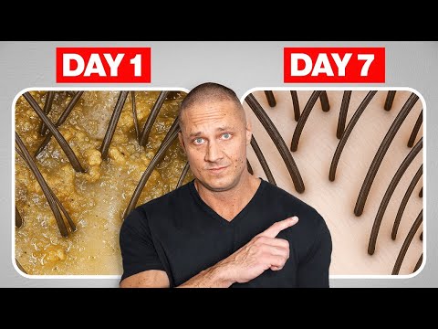 7 Day Hair Detox to SAVE Your Hair
