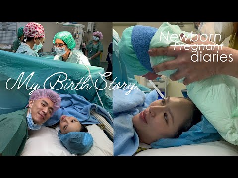 Hello, August🪿 全程很淡定的剖腹生產紀錄片🍼 My C-section experience