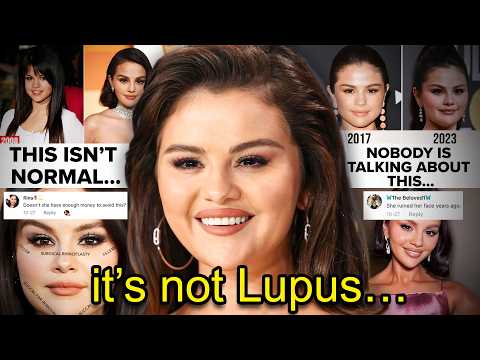 SELENA GOMEZ DESTROYED HER FACE (irreversible damage)