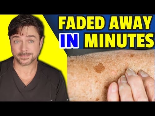 Simple Way To Lighten Skin Marks And Spots In 2 Minutes