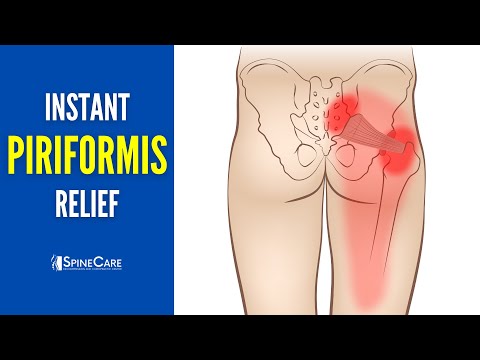 How to INSTANTLY Relieve Piriformis Pain