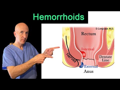 Complete overview of Hemorrhoids