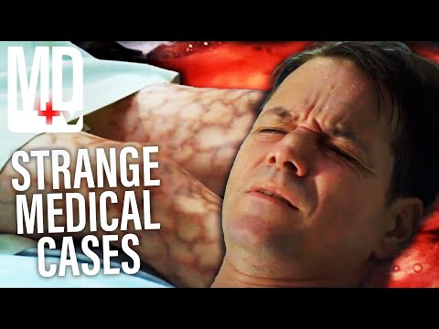 House Diagnosing Rare Diseases For 40 Minutes | House M.D | MD TV