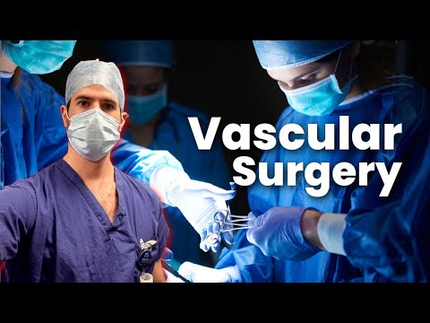 Vascular Surgery Rotation Review - My Life as a Doctor