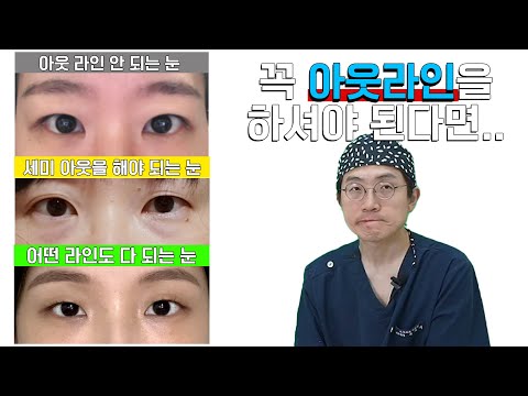 13분이면 성형외과 13군데 상담 시간 아낄 수 있습니다.(오늘 영상은 아주 중요!)