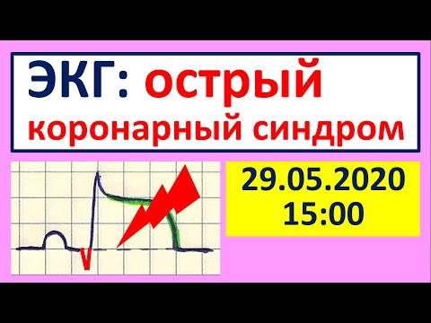 Важнейшие ЭКГ-синдромы: острый коронарный синдром