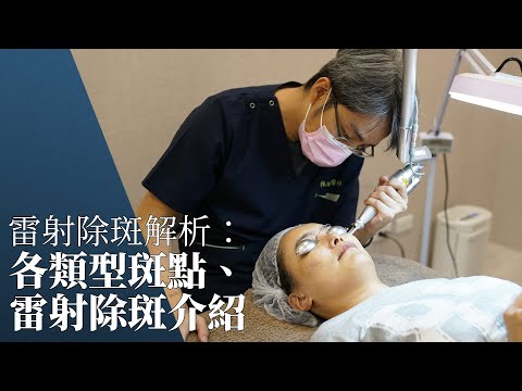 雷射除斑解析:各類型斑點、雷射除斑介紹|W頂尖醫美