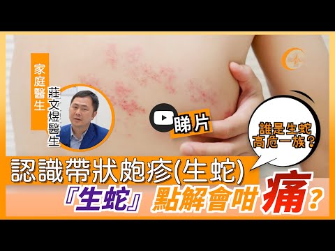認識帶狀皰疹(生蛇)|『生蛇』點解會咁痛?|誰是高危一族? 莊文煜醫生