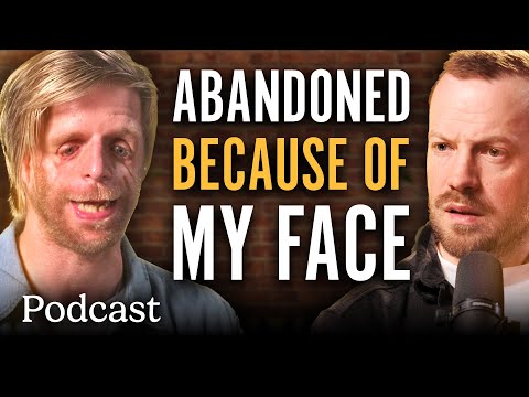 Abandoned At Birth And Bullied: How I Learnt To Love My Face | Minutes With Podcast | @ladbiblestories