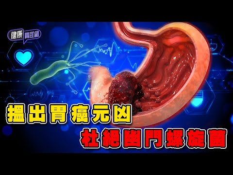 搵出胃癌元凶 杜絕幽門螺旋菌| 健康關注組 | EP335 | 幽門螺旋菌 | 胃癌 | 朱智賢 | 吳雲甫 | HOY TV 77台