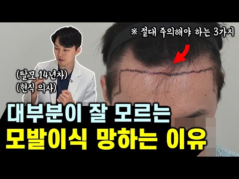 모발이식 실패하는 가장 흔한 이유 5가지 & 추천 관리법 (feat. 병원 선택 꿀팁)