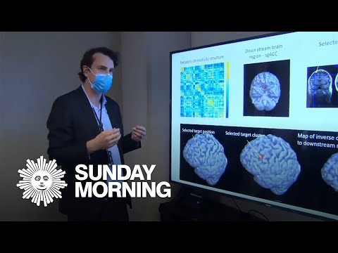 From the archives: Nolan Williams on a promising treatment for depression