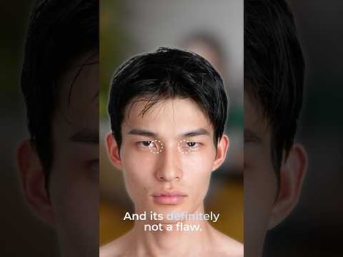 Why do Asians have such small eyes?