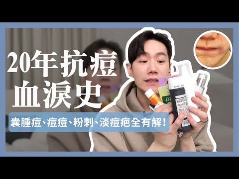 痘肌必看!12款粉刺痘痘藥分享 (加碼急救各類消痘有效小技巧)