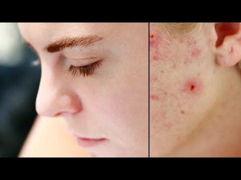 The Power of Frequency Separation with Affinity Photo + Free Project