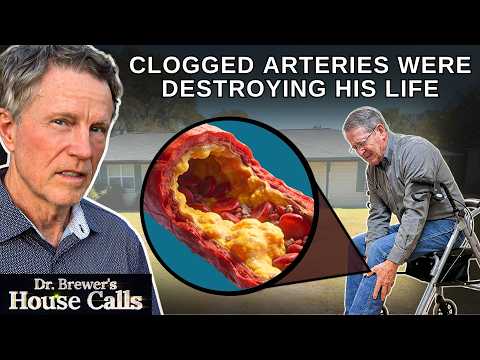 Clogged Arteries Destroyed His Life... Until THIS Happened