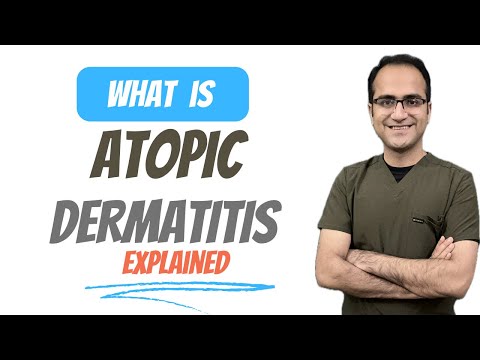 Atopic Dermatitis (Eczema) Medicine Lecture, Pathophysiology, Symptoms, Treatment USMLE NEETPG
