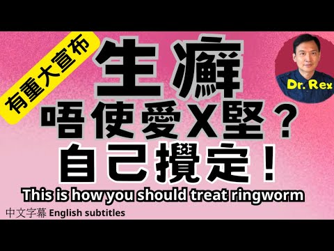 股癬、腳癬痕癢難當? 醫生教你一招K.O. this is how you should treat ringworm
