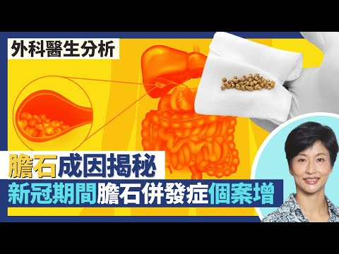 膽石成因揭秘 4F人士膽石風險大增!新冠肺炎疫情期間患膽石出現併發症個案增!膽汁膽固醇及鹽份過高易結石都會遺傳?|王建芳醫生 陳詩正醫生|人類健康研究所