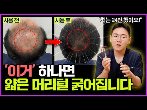 "또래보다 10년은 어려보이는 법..." 저도 이 방법으로 머리 굵어져서 10년 젊어졌습니다🔥