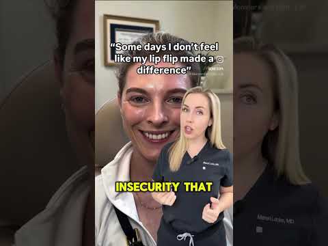 Lip flip to address a gummy smile #lipflip #botox #beforeandafter