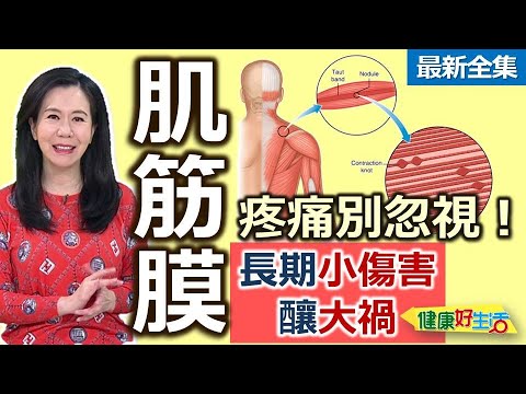 健康好生活 20241023 「肌筋膜」疼痛別忽視!長期小傷害釀大禍!