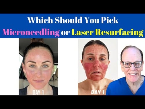 Should You Get Microneedling or Laser Resurfacing? | Plastic Surgeon's Advice