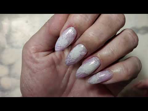 САМА СЕБЕ! ОНИХОЛИЗИС! ХРОНИКА ИЗ 5 РАБОТ!