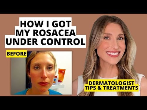 My Rosacea Journey: Dermatologist Shares Skincare & Treatments That Work! | Dr. Sam Ellis