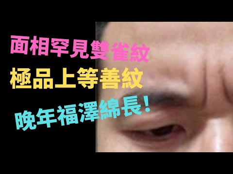 面相罕見雙雀紋,極品上等善紋,晚年福澤綿長!