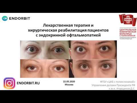 Эндокринная офтальмопатия