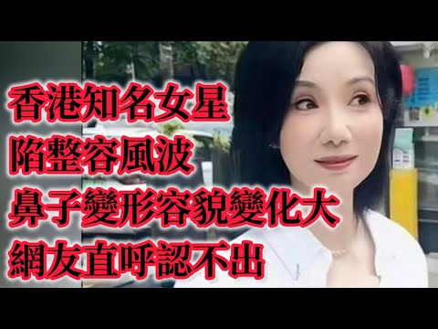 香港知名女星陷整容風波,鼻子變形容貌變化大,網友直呼認不出