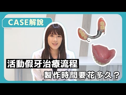 為什麼製作活動假牙要來診所那麼多次?︱活動假牙製作流程︱療程分享