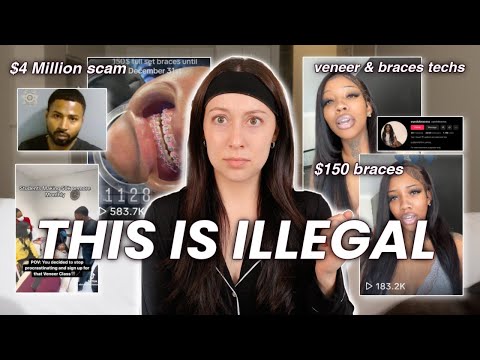 "$150 Braces" 'BracesTechs' of Tiktok! *this is ILLEGAL*