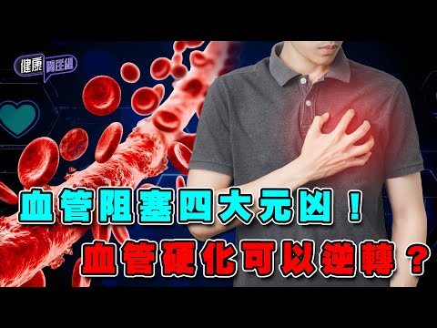 血管阻塞四大元凶!血管硬化可以逆轉? | 健康關注組 | EP328 | 血管硬化 | 血管阻塞 | 中風 | 心臟病 | 敖嘉年 | 黃芳雯 | HOY TV 77台