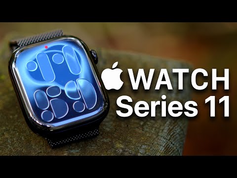 I finally upgraded: Apple Watch Series 11 Review (worth it?)