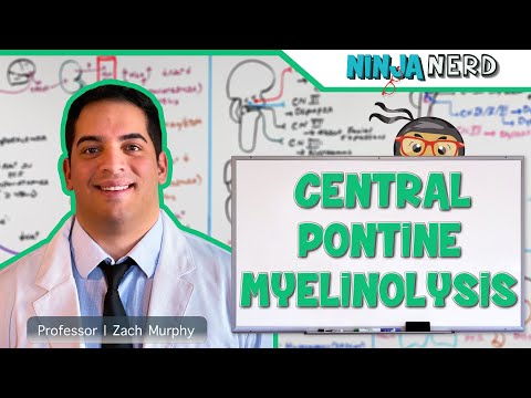 Central Pontine Myelinolysis | Osmotic Demyelination Syndrome