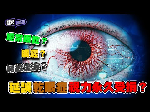 經常眼乾眼澀無故流淚?延誤乾眼症視力永久受損?| 健康關注組| EP283| 乾眼症| 眼乾| 眼澀 | 敖嘉年 | 黃芳雯 | HOY TV 77台