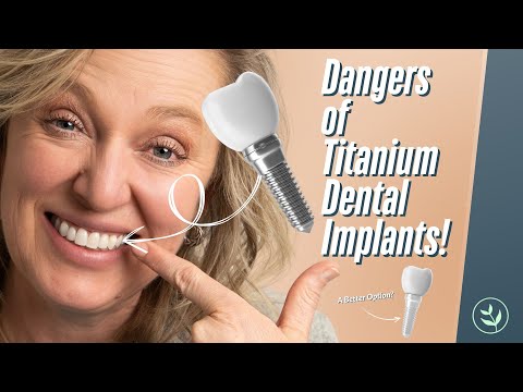 WARNING: The Hidden Dangers of Titanium Dental Implants!