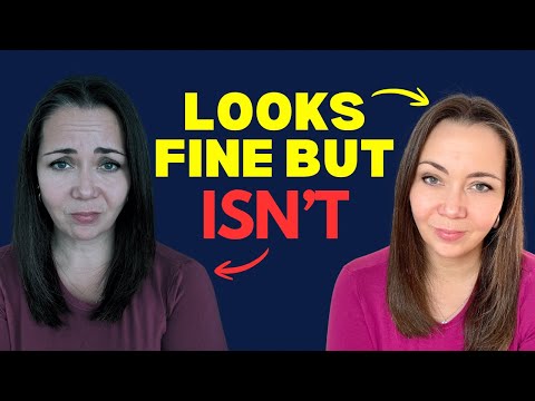 High Functioning Anxiety: What People Don’t See