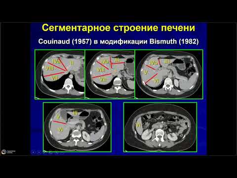 Нормальная и вариантная анатомия печени, желчевыводящих путей и сосудов