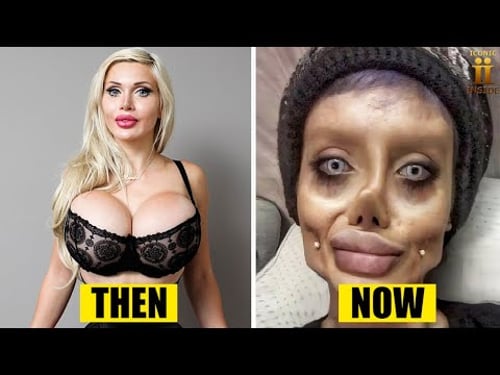 RICH People Who Turned Themselves into PLASTIC!